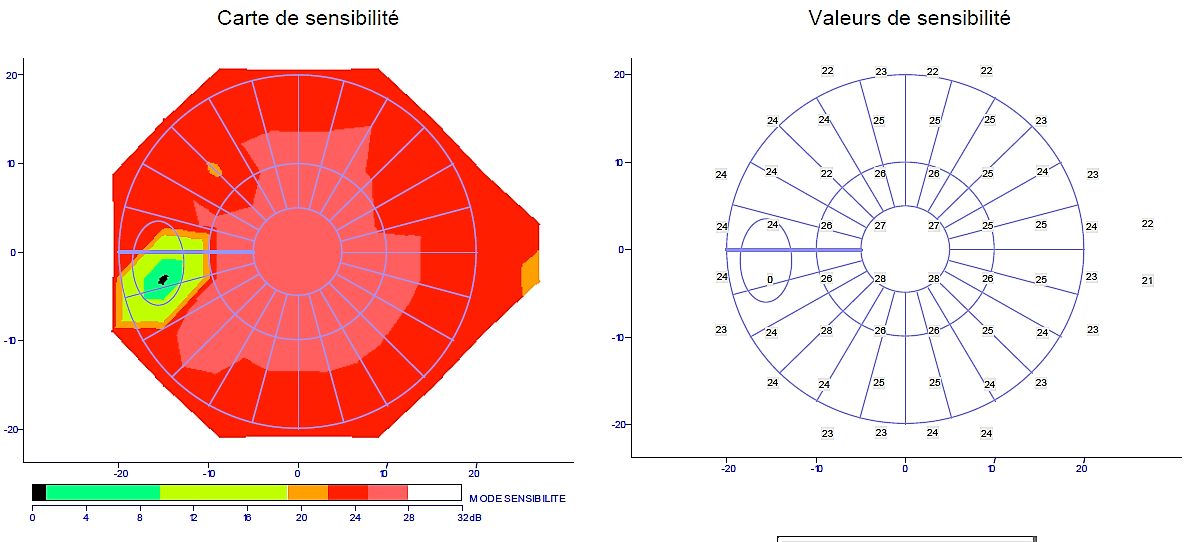 Examen Campo Visual